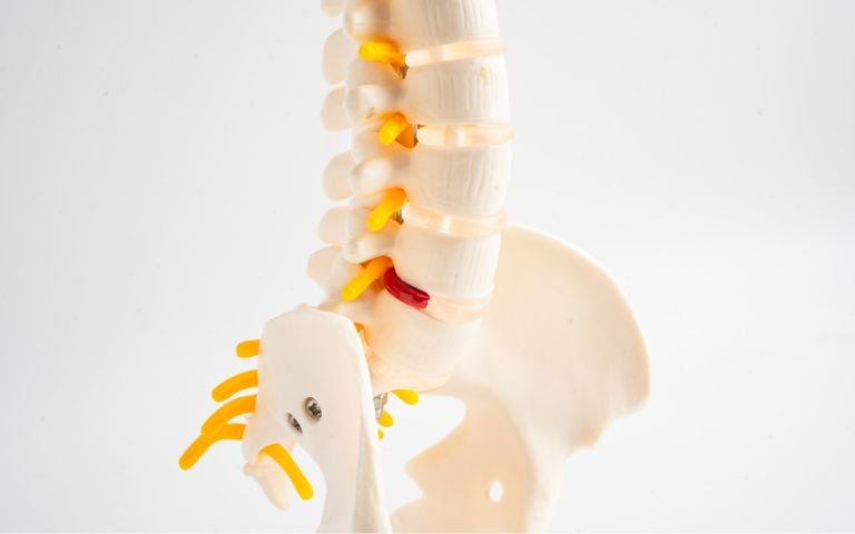 Thoát vị đĩa đệm